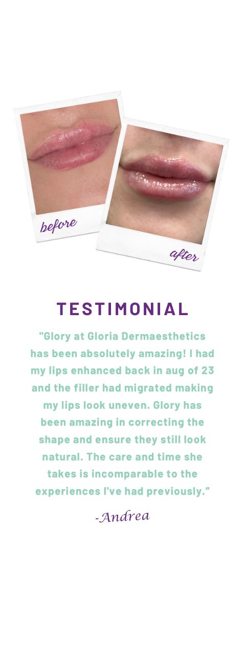 Andrea - Testimonial - Mobile